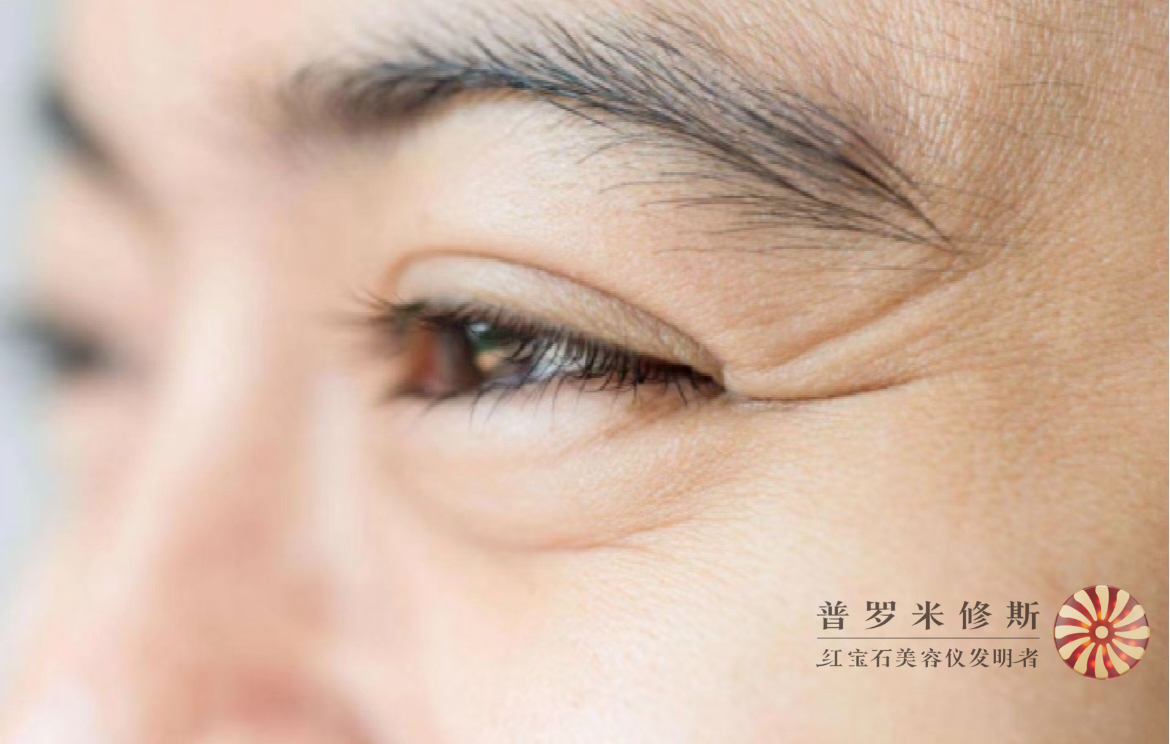 烙鐵們，你的魚(yú)尾紋真的需要熨一下！