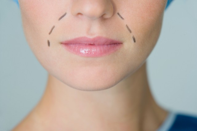 對癥下藥：你是哪種法令紋？