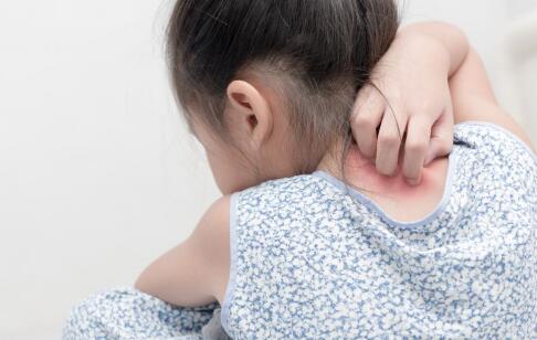 祛痘印的15個日常好習(xí)慣