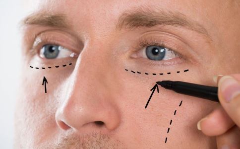 激光祛痘印四大優(yōu)勢(shì)：輕松擁有干凈肌膚的秘密！