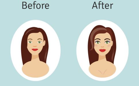 激光祛痘印的優(yōu)勢(shì)：專(zhuān)為女性設(shè)計(jì)，美麗升級(jí)！