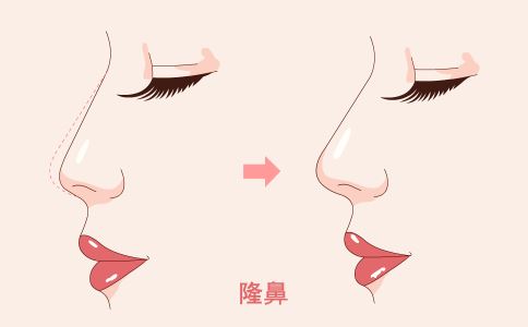 激光祛斑術(shù)后如何護(hù)理