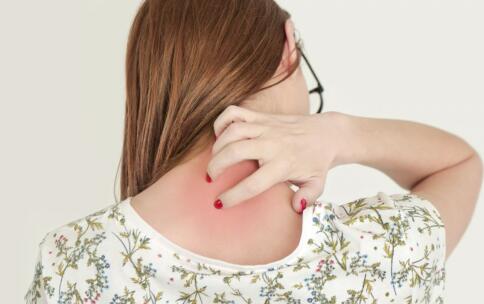 飲食秘方“吃”掉色斑