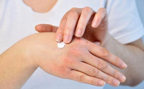 如何區(qū)分不同類型的色斑