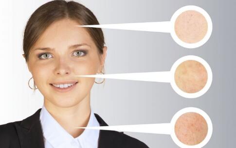 7個壞習(xí)慣 會讓你長一臉的斑