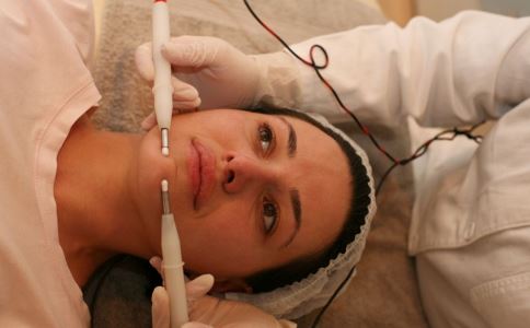 最簡單有效的祛痘方法