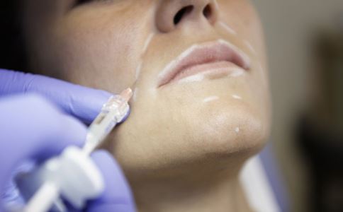 青春期祛痘該怎么做呢