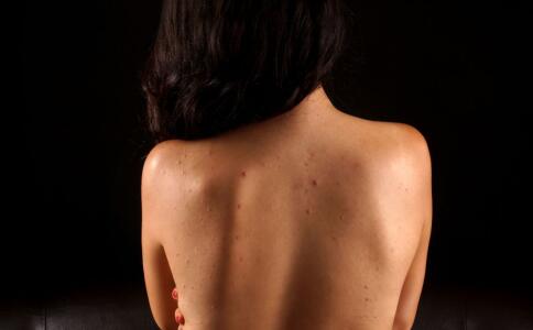 雀斑是怎么來的？