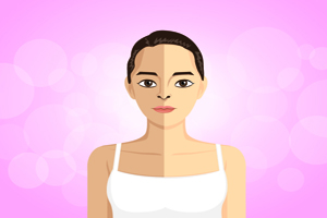 臉上的斑點怎么除