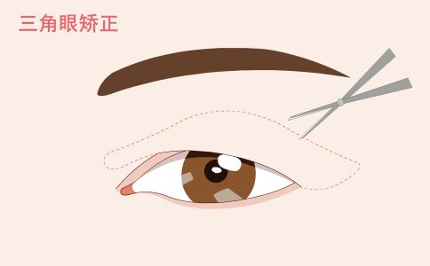 做面部拉皮除皺時應注意什么?