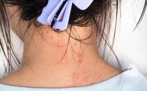 最真實有效的祛皺方法