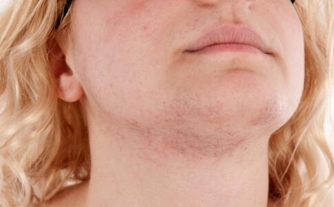 教你熨平皺紋的偏方