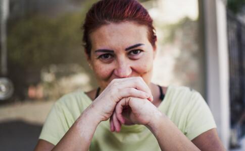 皺紋說明你的身體健康