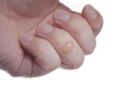 哪些美味可對抗皺紋