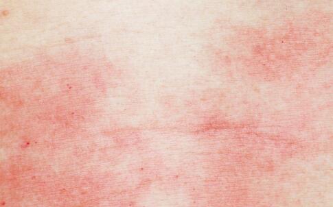 女性護(hù)膚小技巧 阻止細(xì)紋橫生