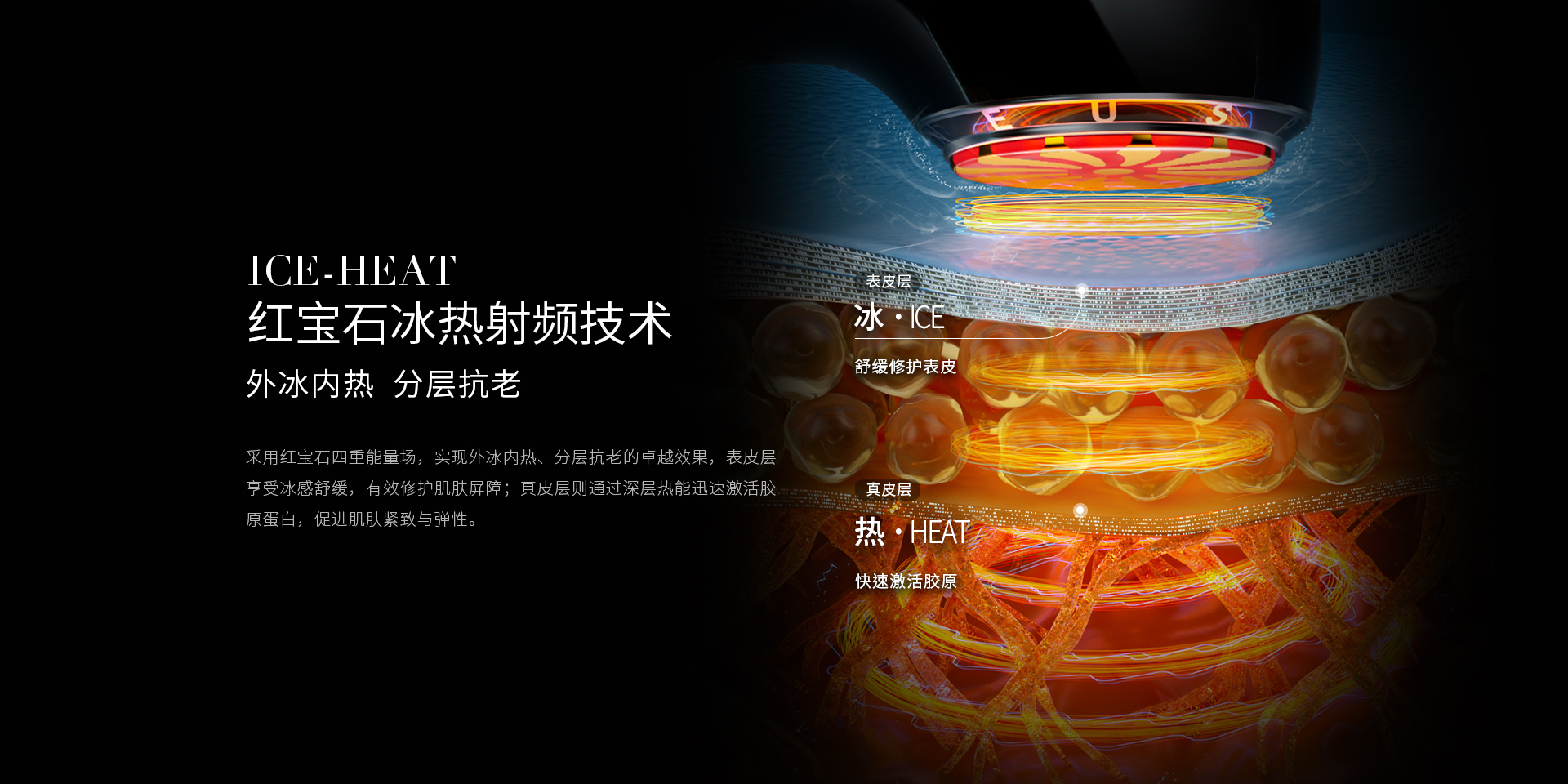 ICE-HEAT紅寶石冰熱射頻技術(shù)